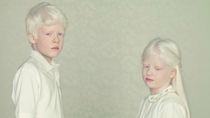 nenes albinos