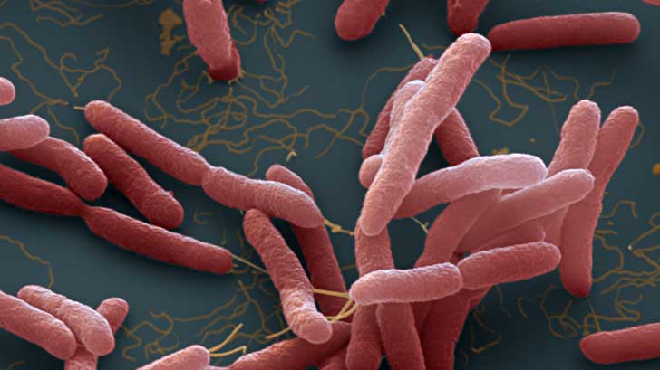 bacteria detectan menores huasabas