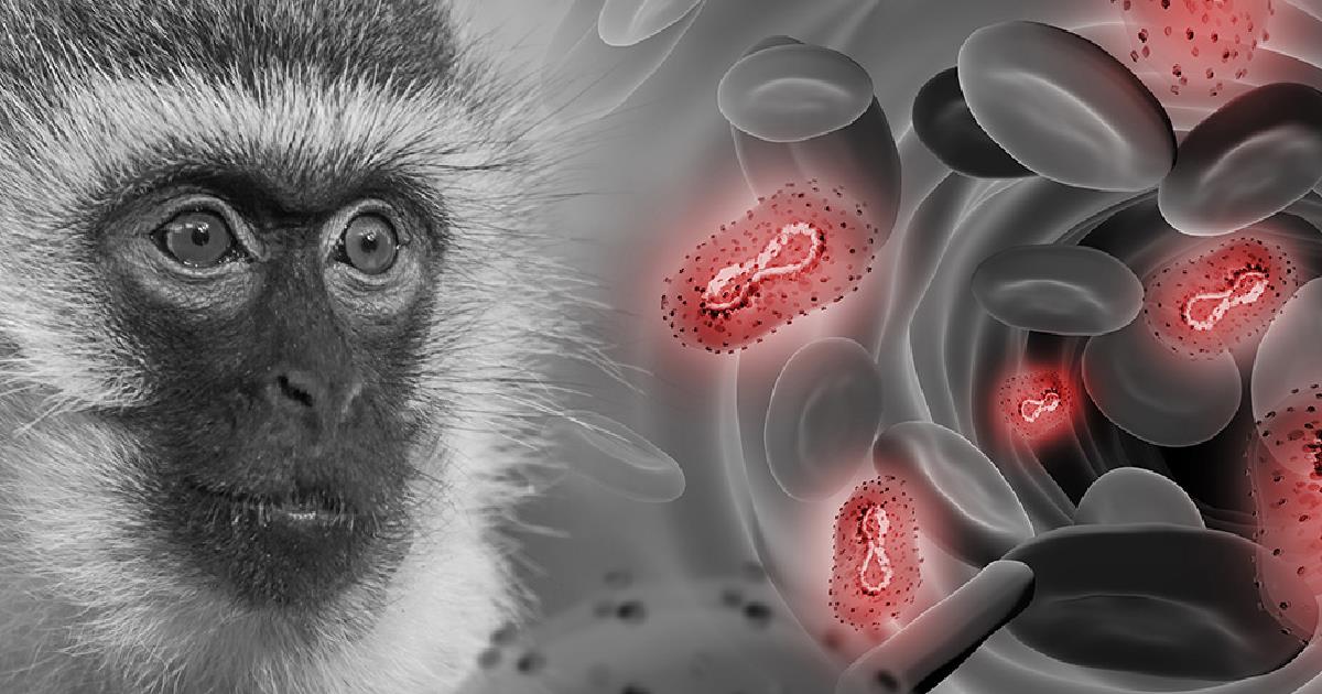 México tiene 91 casos de viruela del mono en 15 estados