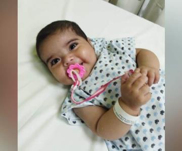Bebé Fátima sale con éxito de cirugía en Cdmx