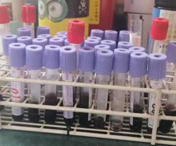 Realiza Cruz Roja Obregón pruebas de dengue por 300 pesos