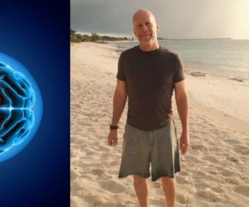 Demencia frontotemporal, la enfermedad sin cura que padece Bruce Willis