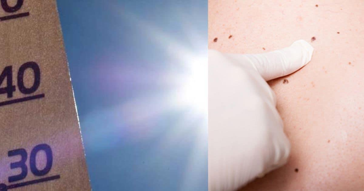 ¡Cuídate del sol! Llaman a protegerse contra el cáncer de piel