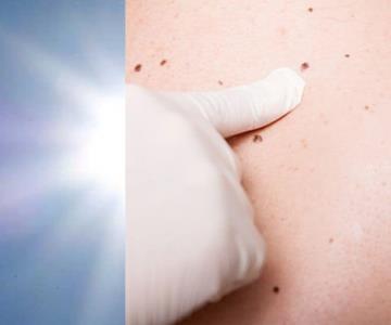 ¡Cuídate del sol! Llaman a protegerse contra el cáncer de piel