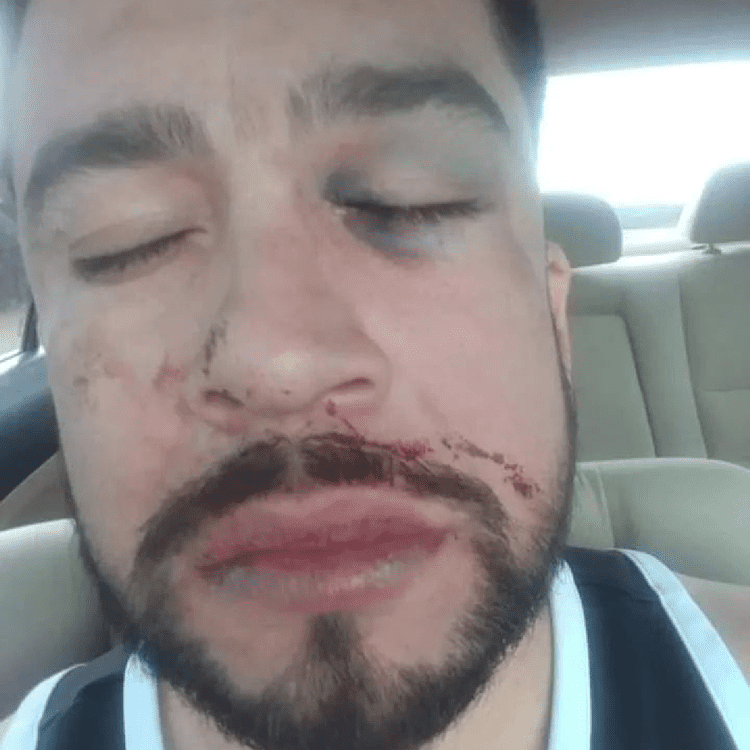 Hasta balazos me tiraron: denuncia presunto abuso policial en San Pedro