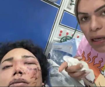 Paolita Suárez se encuentra muy grave en el hospital