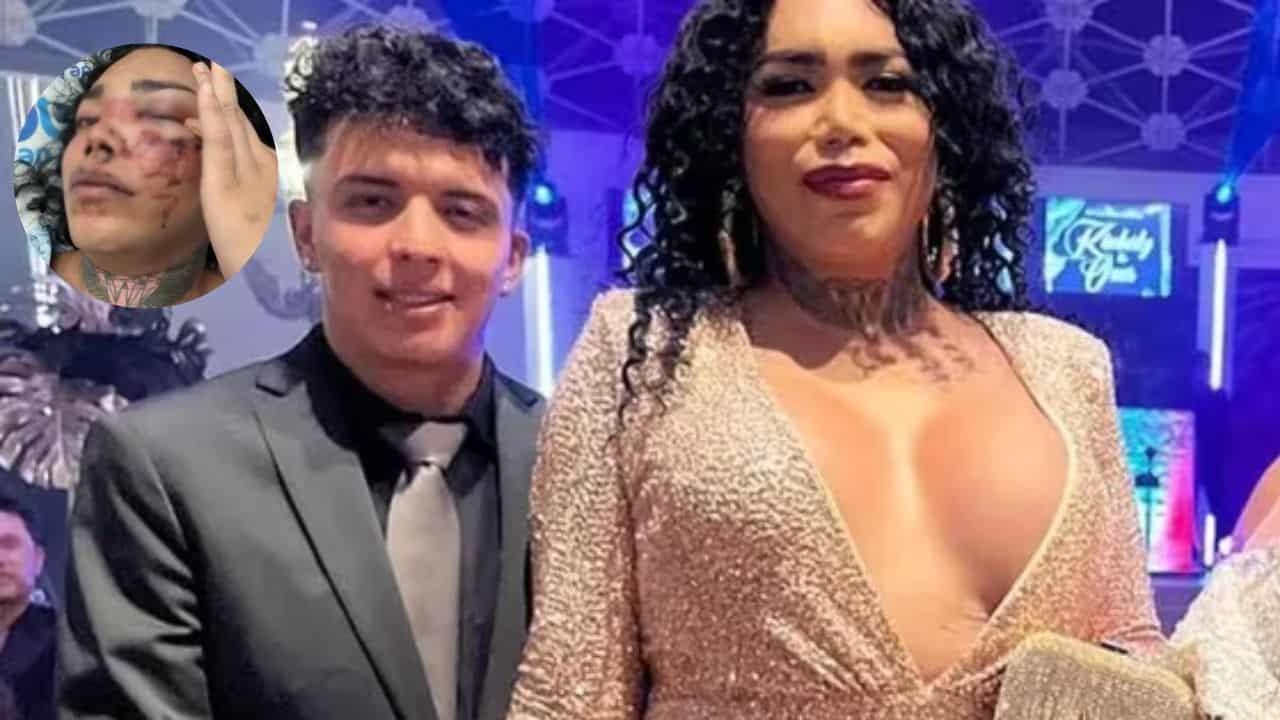 Paola Suárez no perdera el ojo gracias a la atención medica