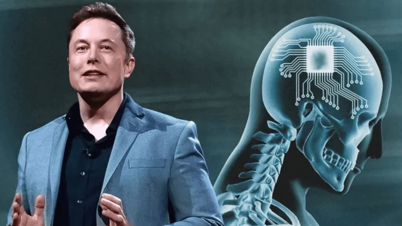 Empresa de Elon Musk realiza el primer implante cerebral en humanos