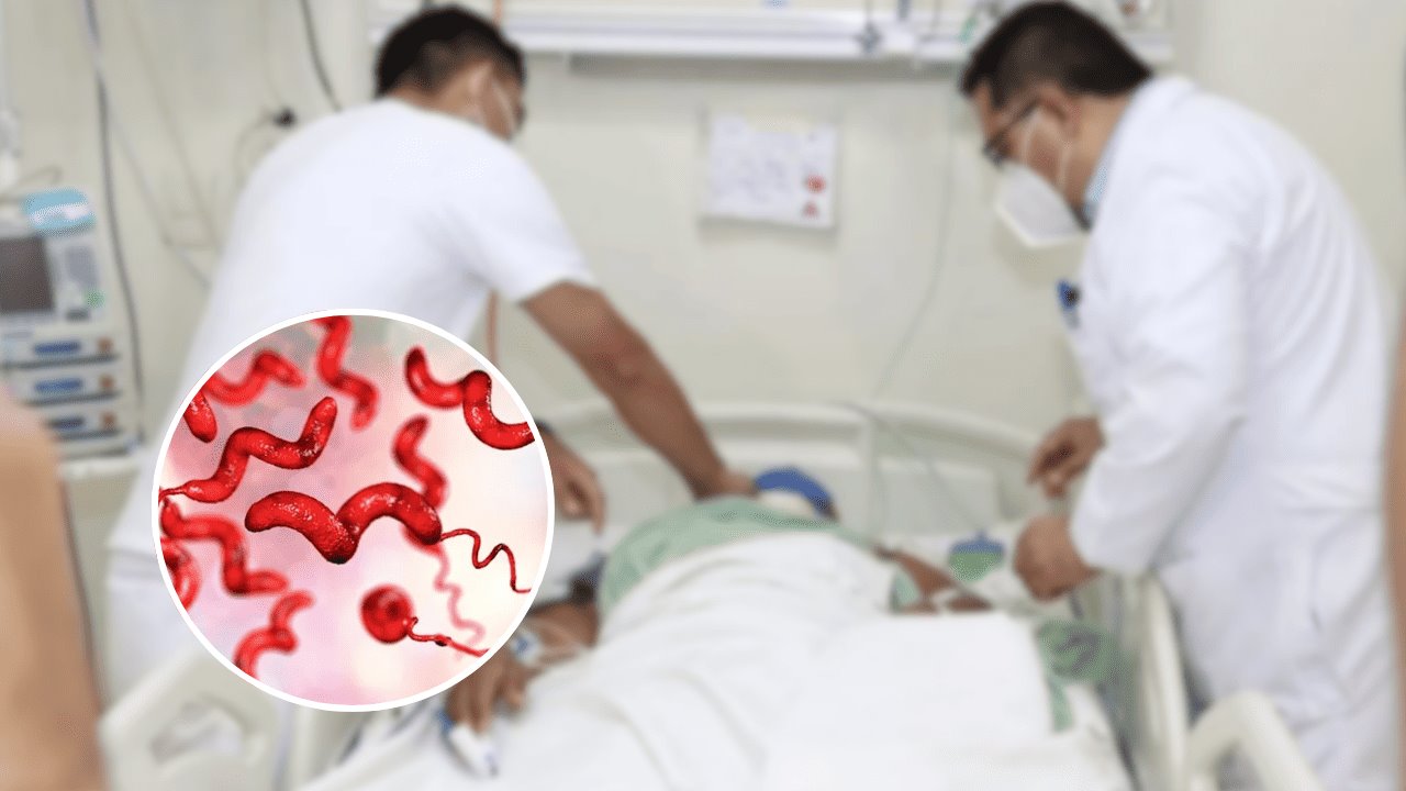Cuatro muertos por brote de bacteria asociada al Síndrome de Guillain Barré