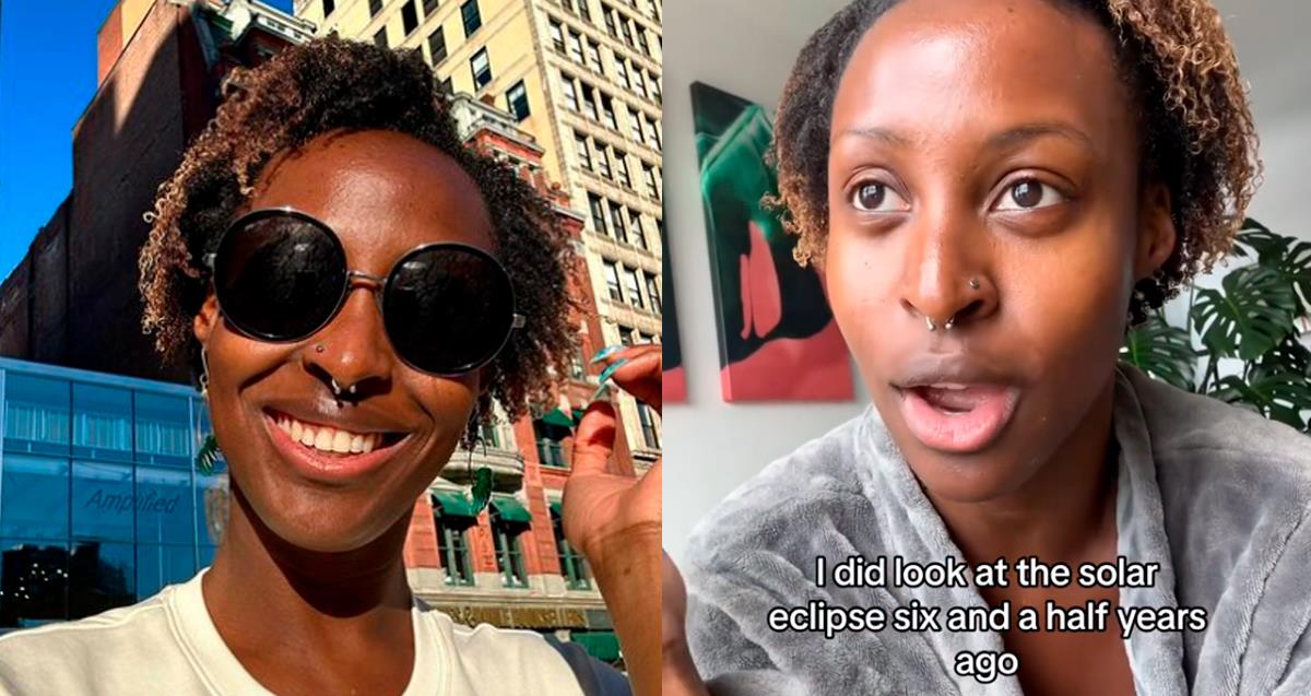 Influencer observa eclipse solar sin lentes y sufre lesiones en su ojo