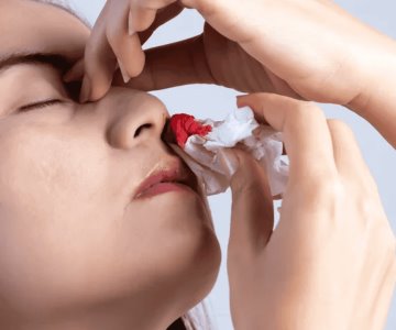 Esta es la razón del sangrado nasal durante las altas temperaturas