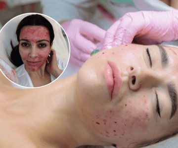 Mujeres se contagian de VIH por tratamiento estético llamado facial vampiro