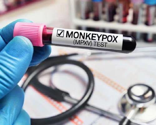 Rebrote de viruela del mono: llaman a vacunarse ante nueva cepa mortal