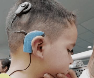 IMSS aprueba implantes cocleares para niños y adolescentes en México