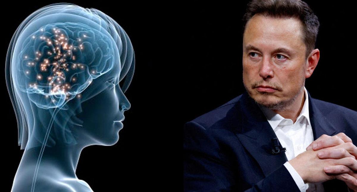 Neuralink implanta su segundo chip cerebral en un paciente humano