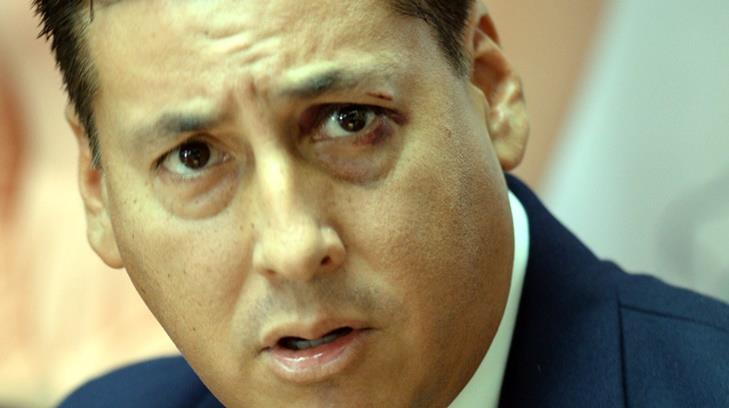 Diputado del PRI pide no adelantar juicios contra Javier Duarte