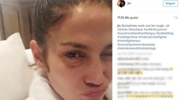 Jennifer Lopez publica foto donde aparece con el ojo morado