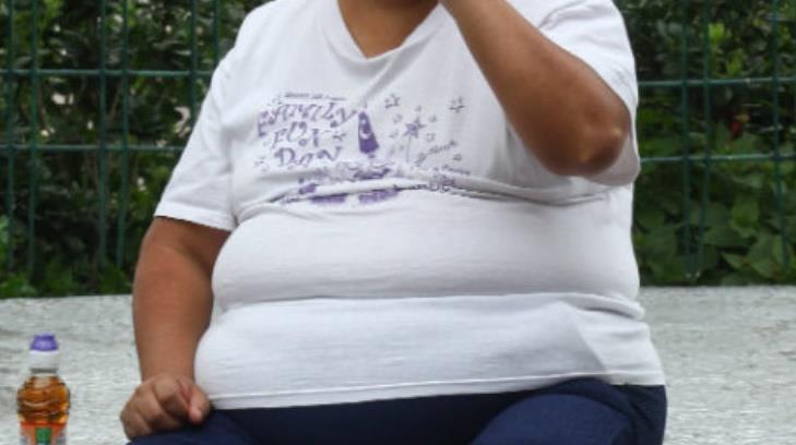 ¿Por qué la obesidad es un factor de riesgo para complicaciones por Covid-19?