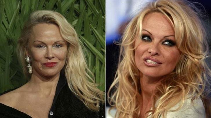 El nuevo rostro de Pamela Anderson sorprende a las redes