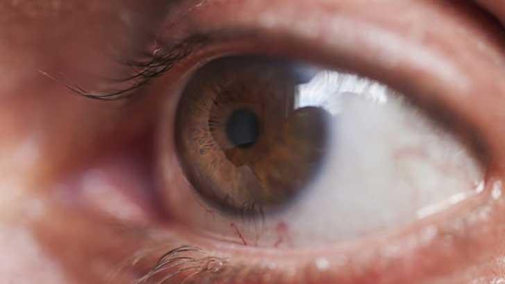 Diabetes, edad y miopía, factores para desarrollar glaucoma, alerta IMSS