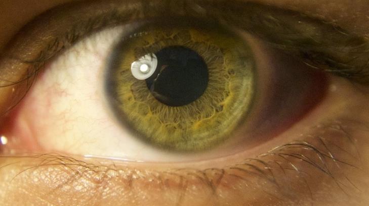 Científicos suecos e israelitas desarrollan una prótesis de retina