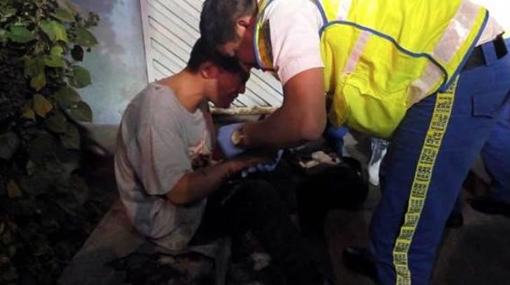 Perro pitbull ataca y mata a un hombre en la Ciudad de México