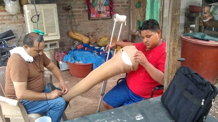 Miguelito cumplirá su sueño de volver a la escuela tras recibir prótesis