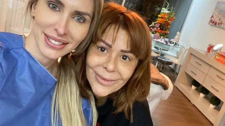 Sorprende rostro de Alejandra Guzmán tras nuevo procedimiento estético