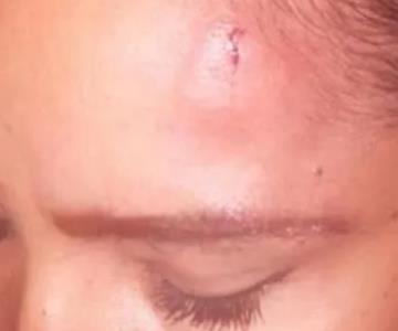 Hombre golpea con piedra a una mujer para robarle su celular