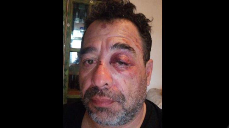 Juan Carlos ‘El Borrego’ Nava sufre caída de la moto
