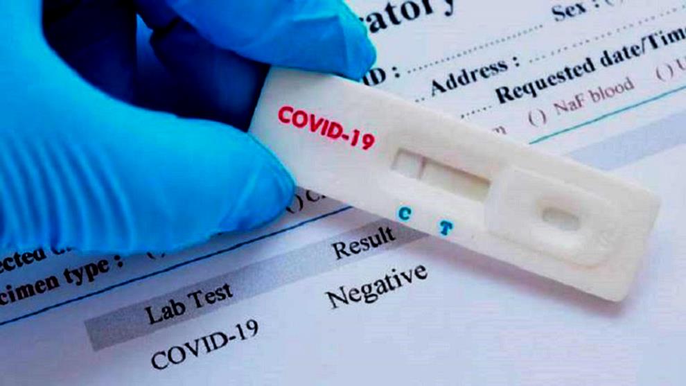 ¿Las pruebas rápidas de Covid-19 de las farmacias funcionan?