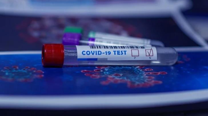 ¿Cuáles son los tests de antígenos, que detectan Covid-19 en minutos?