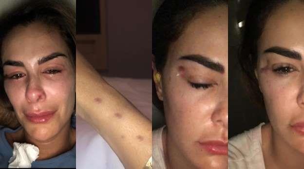 Difunden fotos de Ninel Conde golpeada