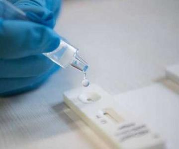 Secretaría de Salud actualiza sus protocolos para buscar Omicron, nueva variante de Covid