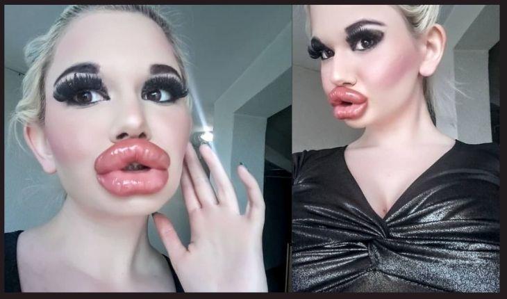 La influencer presume los labios más gruesos del mundo