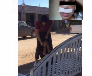 ¿Cuál es el estado de salud de la joven hermosillense agredida en video viral?