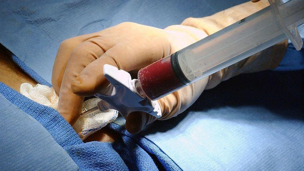 La importancia del trasplante de médula para las personas con EM