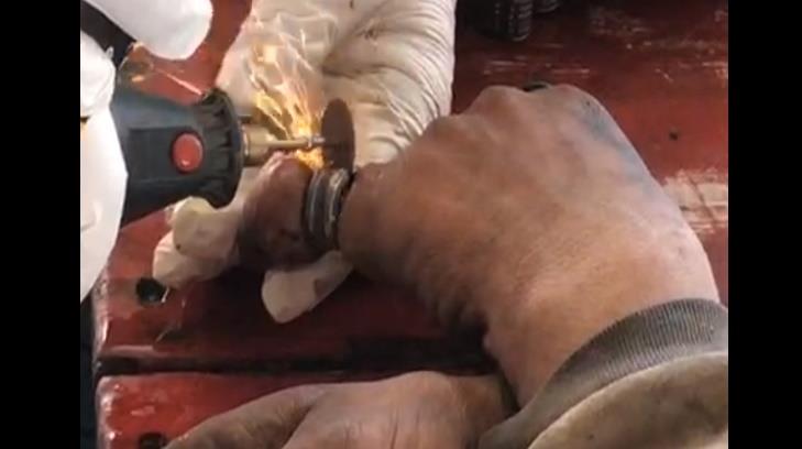 VIDEO - ¡Héroes! Bomberos auxilian a indigente con anillo atorado en el dedo