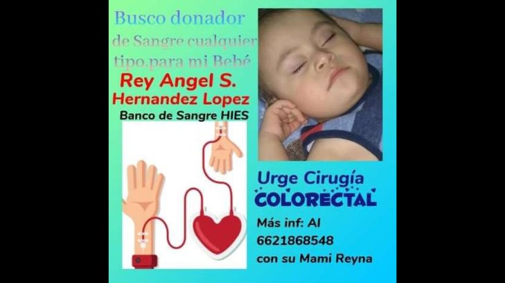El pequeño Ángel necesita sangre para una cirugía; su mamá pide cualquier tipo de apoyo