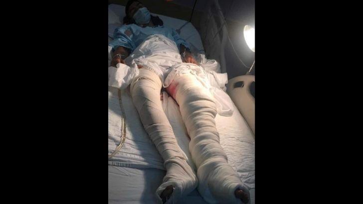 Menor sufre terrible accidente en moto; madre solicita apoyo de sangre